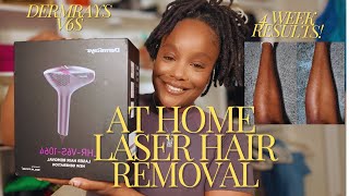 AT HOME LASER HAIR REMOVAL FOR MELANATED SKIN DERMRAYS V6S REVIEW [upl. by Bellamy]