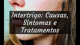 Intertrigo Causas Sintomas e Tratamentos [upl. by Hephzipah]