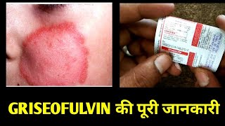 griseofulvin 250mg tablet uses and side effects in hindi GrisovinFP tablets grisopex 250 Tablets [upl. by Ylicic569]