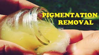 HOW TO GET RID OF PIGMENTATION ON FACE NATURALLY  TRY HOME REMEDIES FOR HYPERPIGMENTATION FACE [upl. by Llerrad]