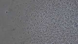 Bacilli and Cocci bacteria colonies from a urine slide culture [upl. by Dahij18]