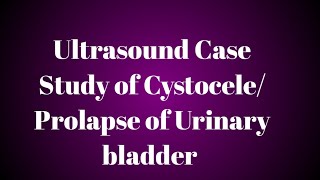 Ultrasound Case Study of CystoceleProlapse of Urinary bladder [upl. by Oak445]