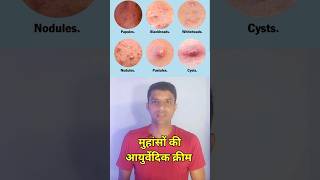 मुहांसों की हर्बल क्रीम।।acne removal creamacne killeraqui plus cream [upl. by Shandee892]