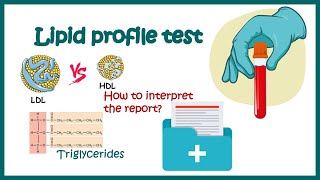 Lipid Profile test  How to read report  What is good and bad cholesterol  What is triglyceride [upl. by Netsrijk]