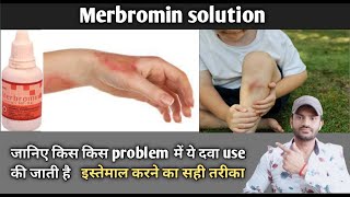 Merbromin solution use benefits and Side effects full review in hindi [upl. by Linnette243]