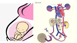 Adaptación del recién nacido a la vida extrauterina [upl. by Anyl]