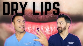 DRY CHAPPED LIPS DERMATOLOGY TIPS [upl. by Faith]