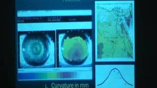 Corneal topography  DrMaged Maherwmv [upl. by Quint]