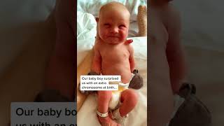 Nothing Down About This Adorable NewBorn downsyndrome fyp babyboy [upl. by Annaid466]