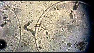 Strongyloides stercoralis no exame de urina EAS [upl. by Ingrid]