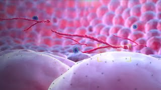 Ebola Virus  Mechanism of Action  3D Medical Animation [upl. by Happy]