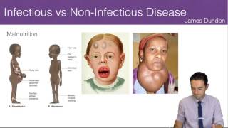 Infectious vs NonInfectious Disease [upl. by Nanreit]