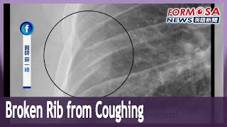 Patient with persistent cough breaks rib in a violent coughing fit｜Taiwan News [upl. by Enyamrahc]