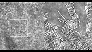 Pseudomonas aeruginosa Twitching Motility Type IV Pili in Action Supplemental Video 1 [upl. by Jak]