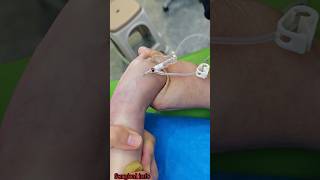 How to insert iv cannula in children song trending shorts [upl. by Emsmus]