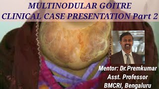 MULTINODULAR GOITRE Clinical case presentation  Part 2 [upl. by Shaikh401]