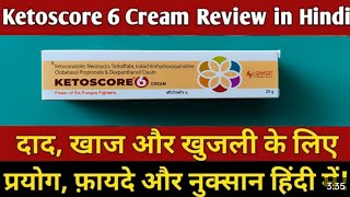 ketoscore 6 cream uses hindi  दाद खाज खुजली की सबसे अच्छी दवाई  केटोसकोर 6 क्रीम [upl. by Elatnahs]