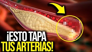 Evita Estos Alimentos Que Dañan tus Arterias y Causan Infartos [upl. by Camarata989]