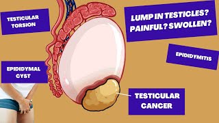 Ive found A Lump In My Testicle Could It Be TESTICULAR CANCER  Causes of Testicular PainLumps [upl. by Ynnhoj]