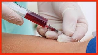 Extracción de Sangre con Jeringa✅ Toma de Muestra Sanguínea [upl. by Nnayhs]