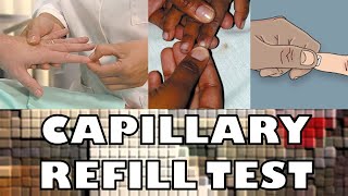 CAPILLARY REFILL TEST  FAST amp SIMPLE  Ohio University  Human Anatomy amp Physiology [upl. by Lletnahc781]