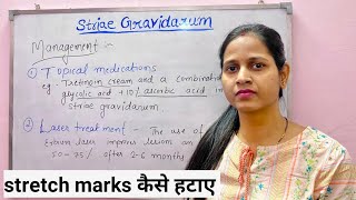 Striae Gravidarum  Stretch marks in pregnancy स्ट्रेच मार्क्स का बचाओ और इलाज [upl. by Alabaster455]