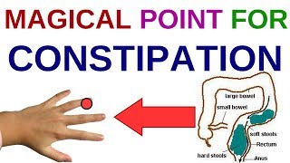 ACUPRESSURE POINTS For CONSTIPATION Constipation And GAS  Constipation And PILES [upl. by Trudie]