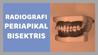 Teknik Radiografi Intraoral Periapikal Bisektris  Bisecting Radiologi Dental [upl. by Noraed157]