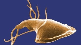 Giardia What You Should Know [upl. by Eldrida]