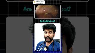 తిన్న వెంటనే మోషన్ వెళ్తున్నారా అయితే ఈ వీడియో చూడండిDrVikranth Chunduri [upl. by Lowry391]