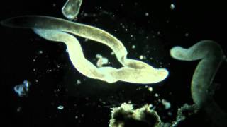 Spirostomum la conjugaison [upl. by Llecrad]