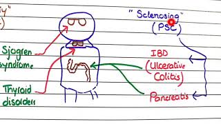 Primary Biliary Cholangitis and Primary Sclerosing Cholangitis  Pathology [upl. by Ennoira]