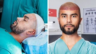 I Went To Turkey For A Hair Transplant [upl. by Heilman]