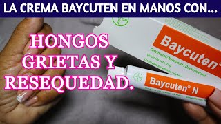 Cómo usar la CREMA BAYCUTEN en tus MANOS y cualquier AFECCION EN LA PIEL [upl. by Riatsala]