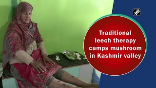 Traditional leech therapy camps mushroom in Kashmir valley [upl. by Viscardi485]