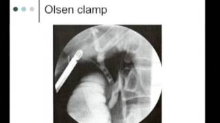 IntraOperative Imaging of the biliary system  Cholangiography [upl. by Yenobe]