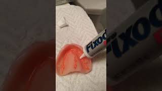 Denture adhesive how to video [upl. by Alana]