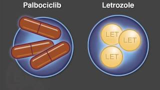 Palbociclib and Letrozole for Advanced Breast Cancer [upl. by Nevin]