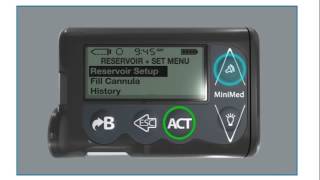 How to Insert the MiniMed Quickset Infusion Set Rewinding the Pump Part 1 of 4 [upl. by Aserehs468]