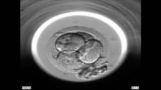 Embryoscope at Fertility Specialists of WA [upl. by Inanuah]