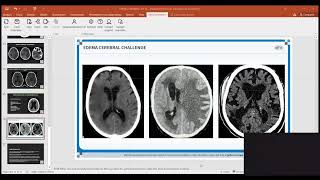 Neurología Pediátrica  imágenes [upl. by Angela]