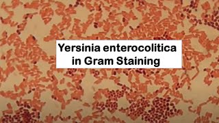 Gram Negative Rods of Yersinia enterocolitica [upl. by Angell732]