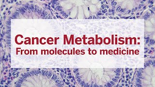 Cancer Metabolism From molecules to medicine [upl. by Boeschen]