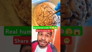 Real human brain 🧠😱 science humanbrain reaction viralvideo shortfeed trending [upl. by Olin]