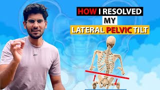 How I resolved my Lateral Pelvic Tilt [upl. by Eremihc]