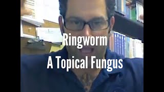 Ringworm A topical fungus [upl. by Pomfrey445]