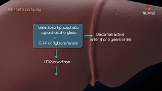 Metabolism of galactose Classic Galactosemia Galactokinase deficiency [upl. by Caritta387]