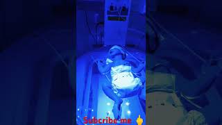 PHOTOTHERAPY IS A TREATMENT NEWBORN BABY niculife hospital baby viralbaby [upl. by Aremahs]