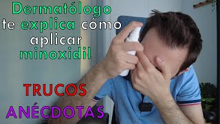 MINOXIDIL ORAL 💊 es la solución definitiva para alopecia o es un TIMO [upl. by Ecinej]