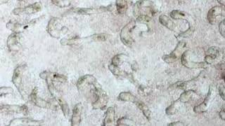 Schistosoma mansoni larvae cultured for 6 days [upl. by Anatsirhc]